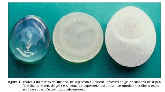La silicona de las prótesis mamarias